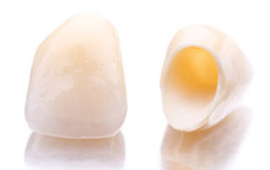 Безметалловые керамические коронки на основе оксида циркония