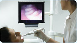 Внутриротовая видеокамера